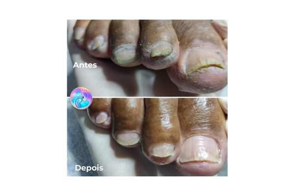 Foto de antes e depois do tratamento 9